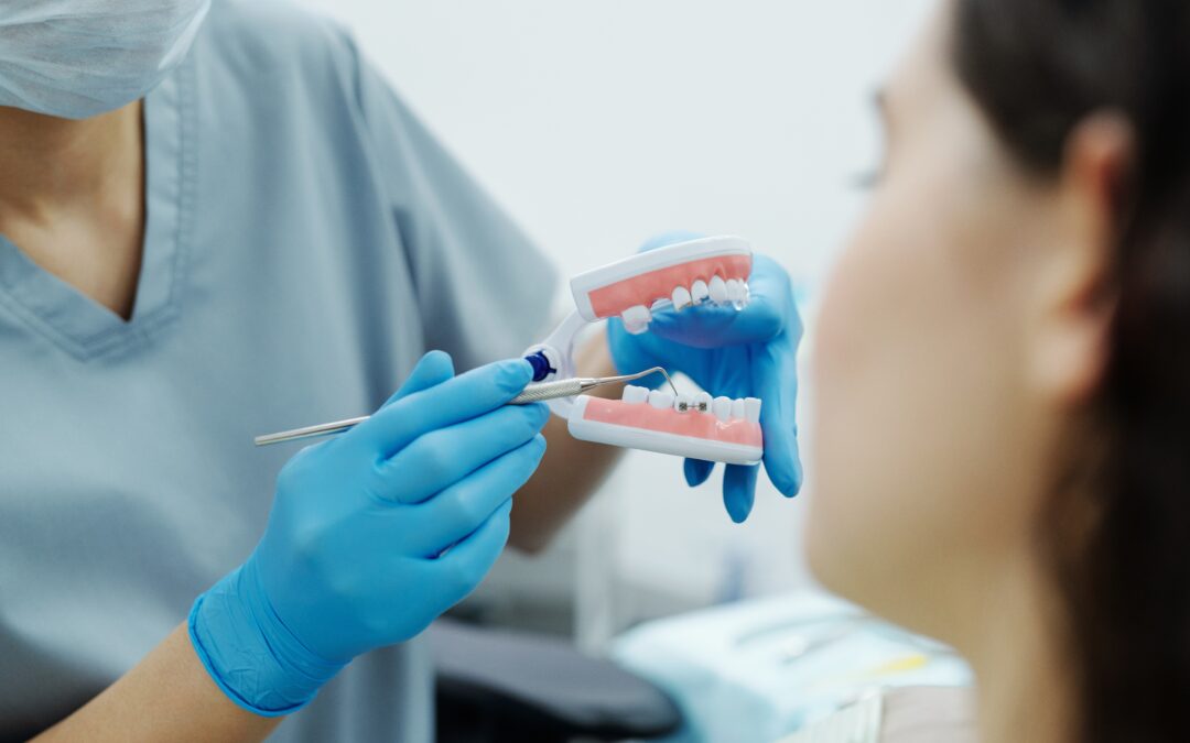 Apiñamiento dental: ¿cómo corregir los dientes montados?