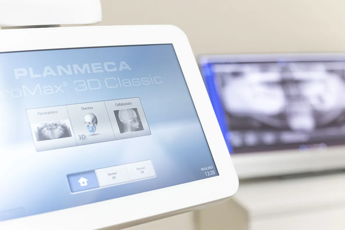 Equipo Planmeca 3D TAC dental en la clínica dental Gurpegui de San Adrián