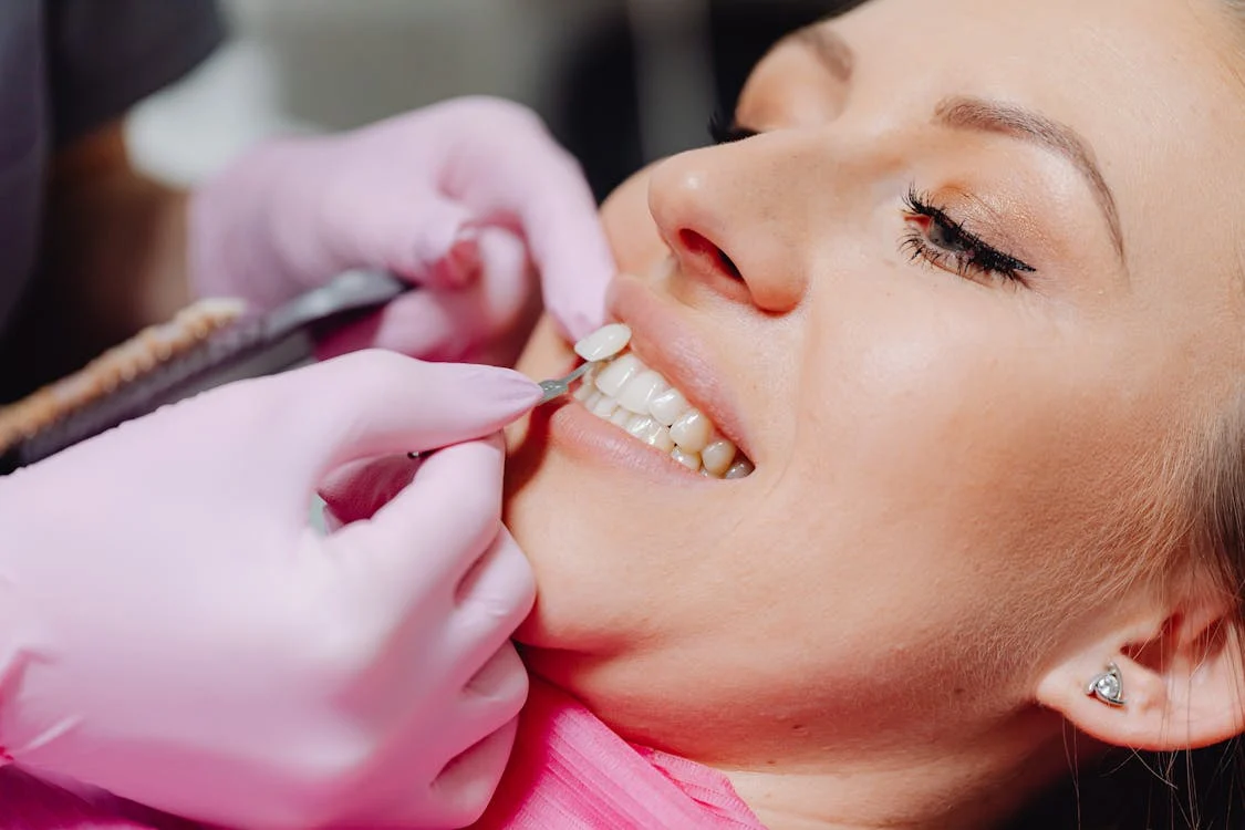 Carillas dentales en Logroño Sur - Estética dental con carillas de porcelana