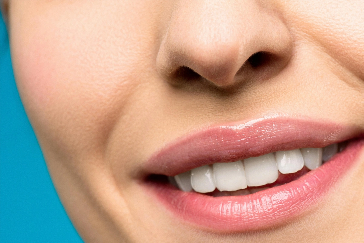 Dientes sanos y blancos tras limpieza dental profesional